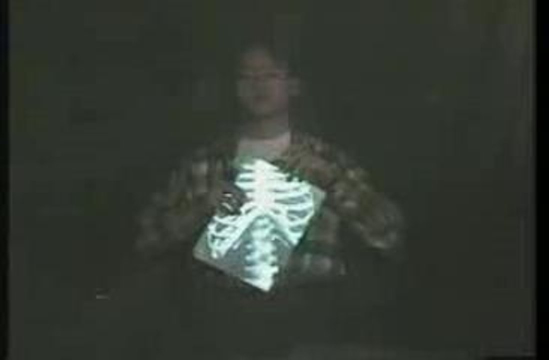 bone2