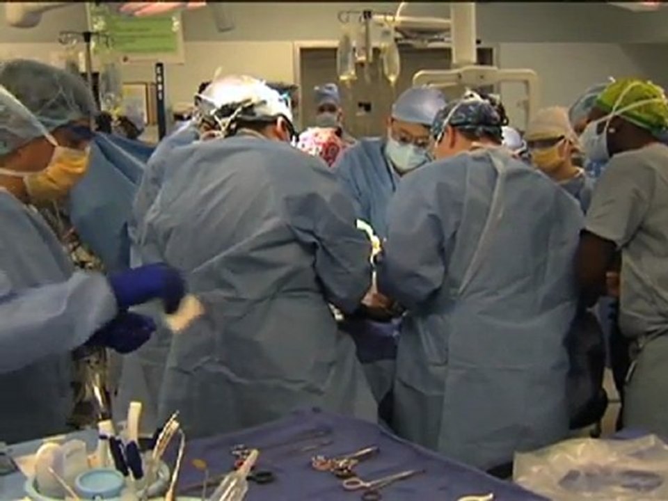 Erstmals komplettes gesicht in den usa transplantiert