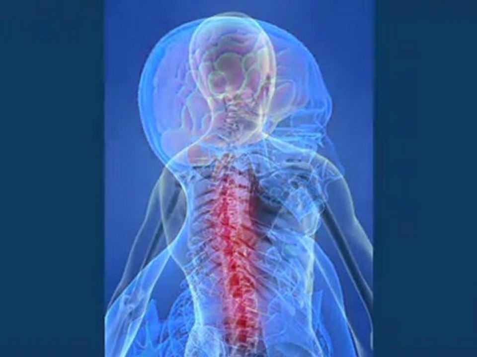 Fibromyalgie: faire parler la douleur