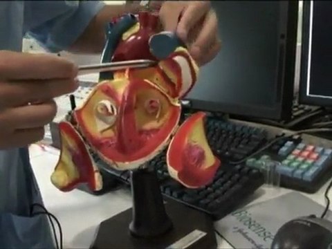 ¿Qué es la fibrilación auricular Arritmias del corazón