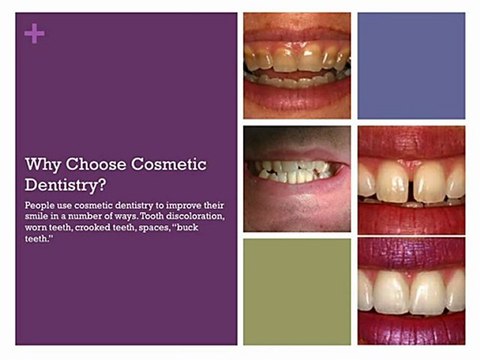 Cosmetic Dentistry Mesa - Cosmetic Dentist Mesa - CAll US Today!