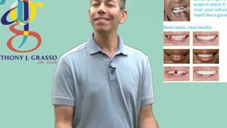 Expert Syracuse Dentist on the Snap on Smile