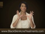 How to Get Rid of Acne Scars on Black Skin - RX for ...