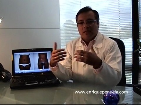 Dr. Jorge Enrique Peñuela - enriquepenuela.com - Abdominoplastia o Lipectomía