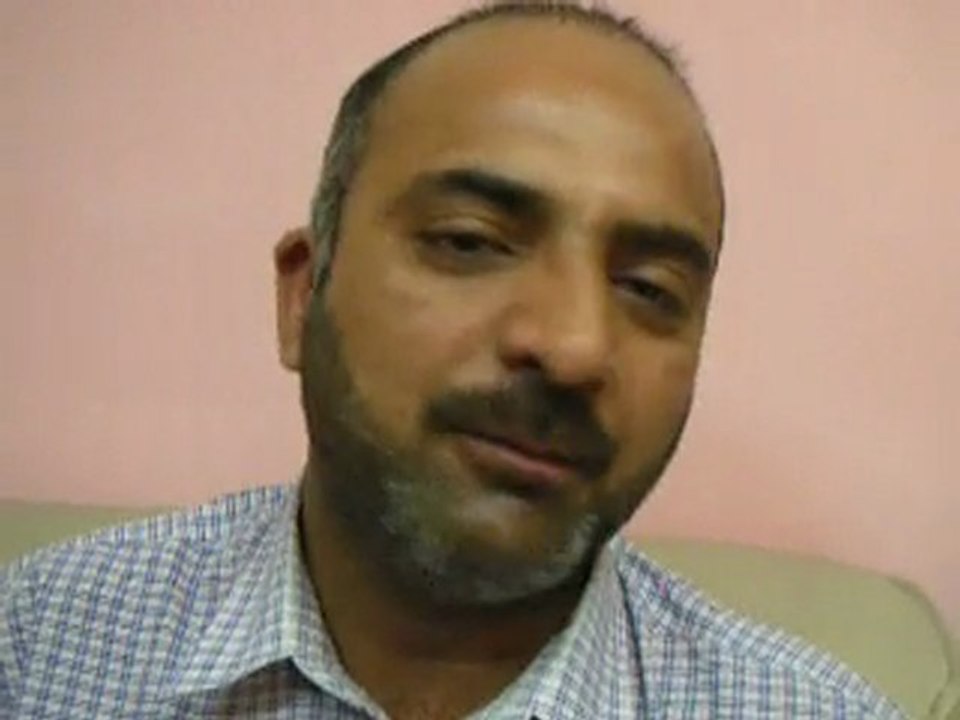 Hair Transplant in Cosmoderma Clinic Lahore Pakistan