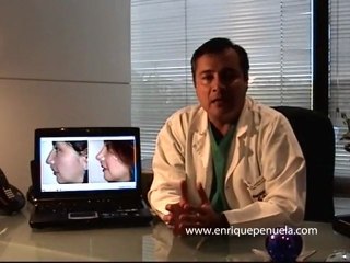 www.enriquepenuela.com - Implantes Faciales - Dr. Jorge Enrique Peñuela - Parte 1