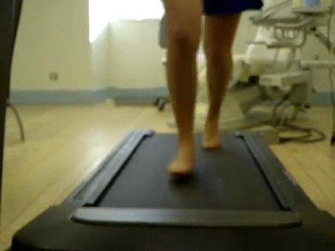 Course et Analyse de la course sur tapis de marche chez le podologue du sport