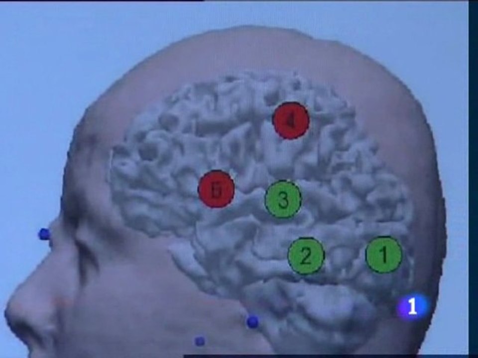 Cerebro tartamudo: Investigacion cientifica