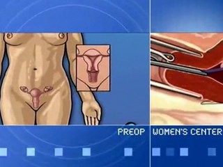 PreOp Surgery Centers of Excellence