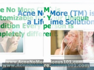 acne treatment reviews - natural remedies for acne - home remedies for acne scars