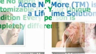 acne treatments that work - how to get rid of acne overnight -how to get rid of acne scars fast