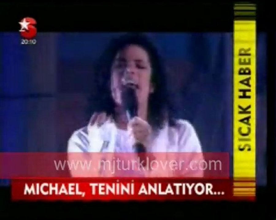 Michael Jackson neden beyazlıyor?