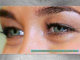 dark circles treatment - dark circles around eyes - how to remove dark circles