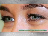 dark circles under eyes causes - how to get rid of dark circles - home remedies for dark circles