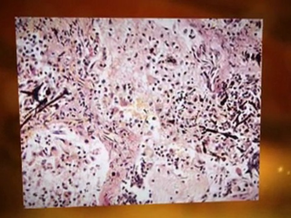 Asbestos removal Edwardsville