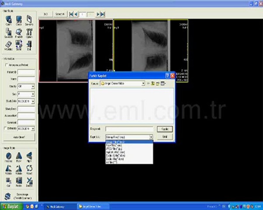 Angell X-RAY Scanner