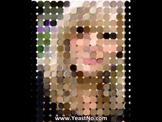 Is Yeast Infection Contagious