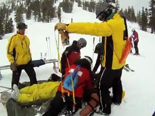 Snowboarding Face Smashed on a Tree (Concussion & Broken Ribs) [ HD ] Podcast N°2