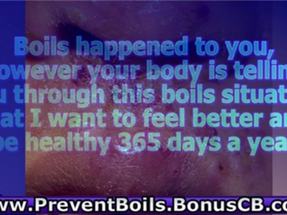 treating boils - home remedy for boils - how to prevent boils