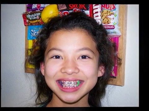 Who's the best Orthodontist in Fairfield, CA? Dr. Marino.