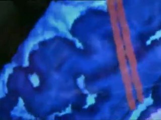 Mon corps ce héros : Le cerveau  - 02/03