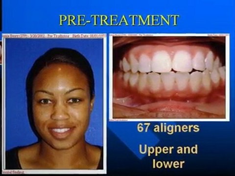 Free orthodontic exam in Vacaville with Dr. Marino