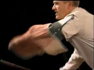 Which Dog Has The Biggest Bite?