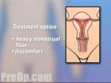 Hysterectomy Removal of Uterus, Ovaries and Fallopian Tubes Surgery - Body