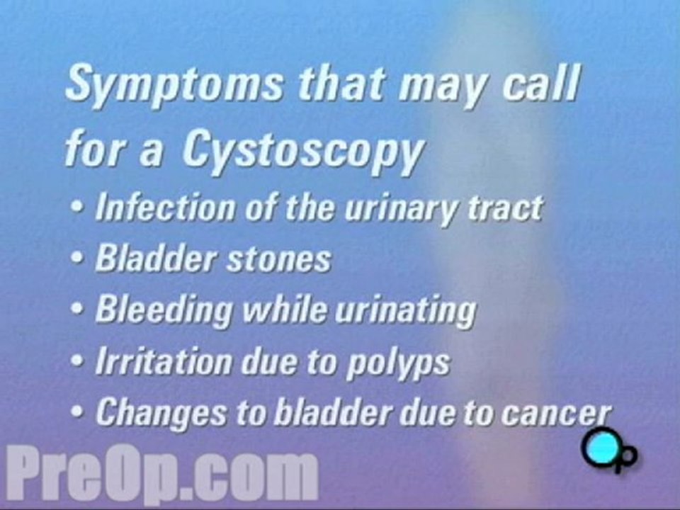 Cystoscopy Male - Body