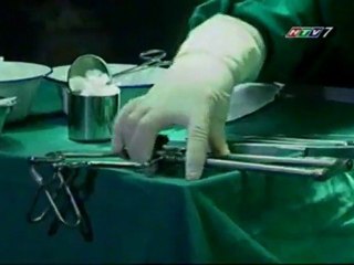 Chuyen tinh thuong hai 17D