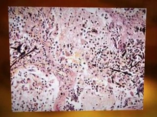 Asbestos removal  Pekin