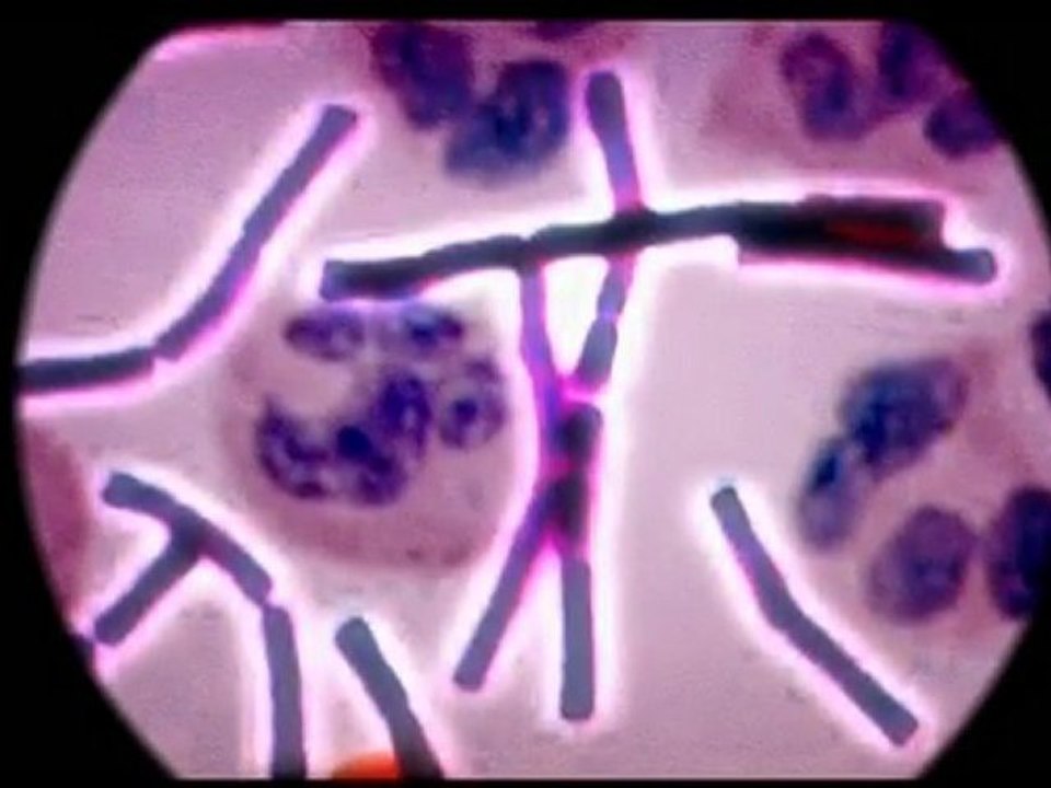 The "Big 6" deadly microbes