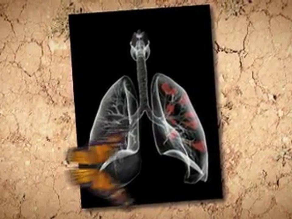 Asbestos Removal in Home Normal