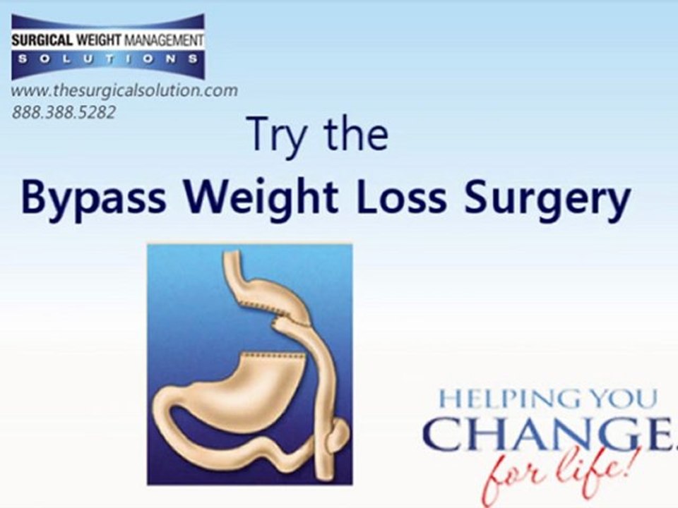 The Dallas Gastric Bypass Weight loss Surgery