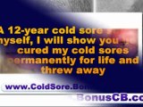 treatment for cold sores - best cold sore treatment - home remedy for cold sores