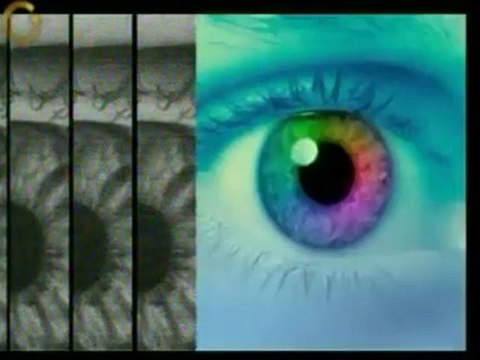 La cirugía plástica ocular abarca tanto intervenciones estét