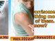 how to remove a skin tag yourself - skin tags home remedies - removing skin tags at home