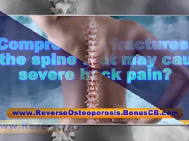 treatment for osteoporosis – treatment for osteoarthritis