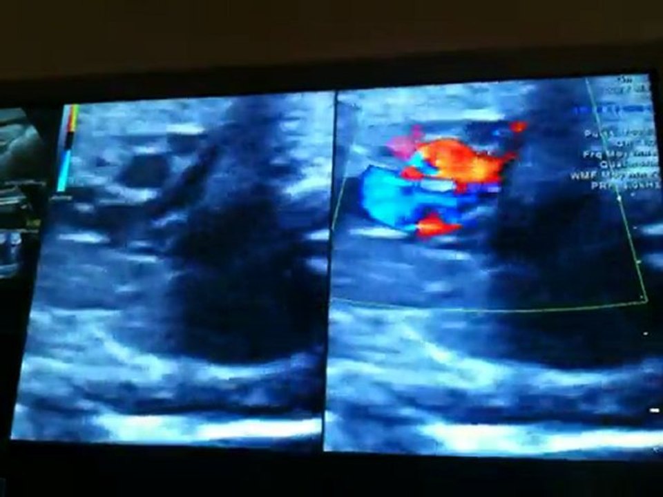 Echographie 27 Avril 2011