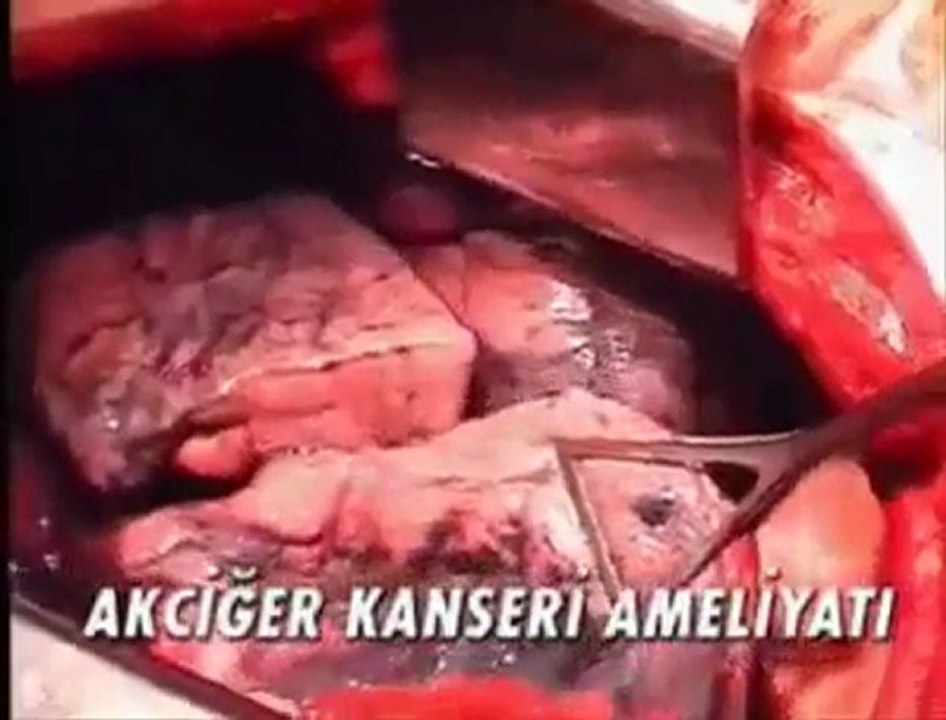 sigaranın zararları