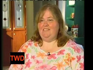 420 Pound 8 Year Old Girl ( David Spates )