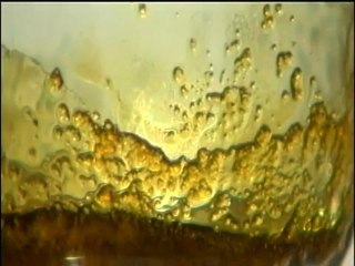 Dad Gives Toddler Battling Brain Cancer Medical Marijuana