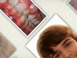 Houston Orthodontics April2011