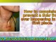 how to get rid of scars on face - acne scars home remedies - removing acne scars