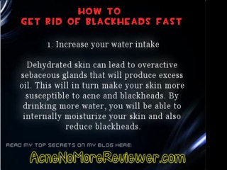How To Get Rid Of Blackheads Fast