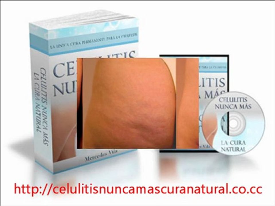 CELULITIS NUNCA MAS LA CURA NATURAL