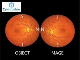 Ophtalmoscope Teamalex Medical