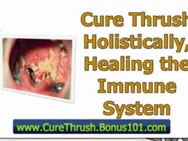 thrush treatments – thrush treatment natural – male thrush treatment