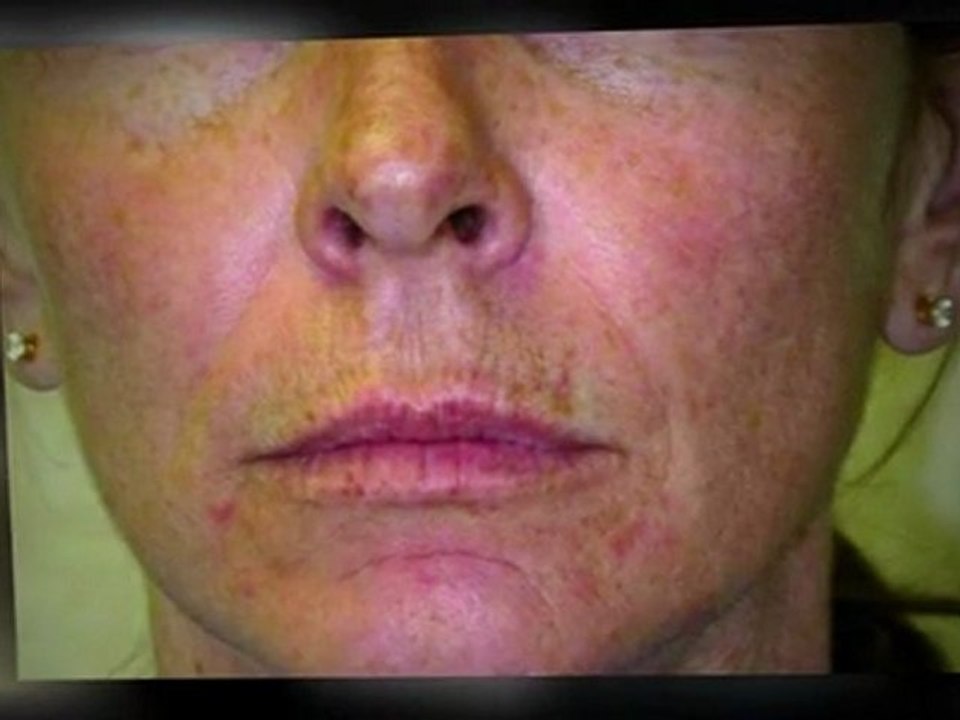 San Francisco Spa Treatment - San Francisco Spa Treatment