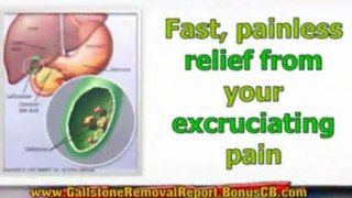 gallstone pancreatitis treatment - gallstone natural remedy